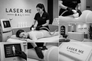 Laser Hair Removal